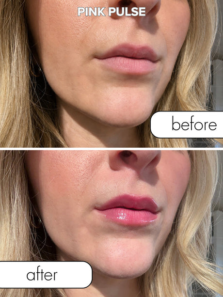 Before and after image showing the effect of Eye Of Love Matchmaker Pink Pulse Pheromone pH Lip Stain on lips.